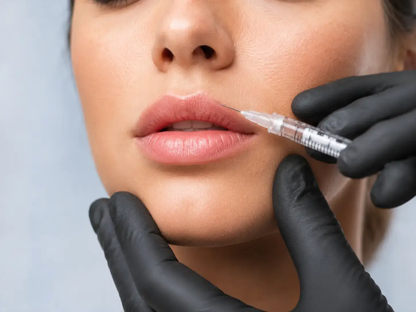 Lip Filler Treatment — natural lip enhancement, Durban North
