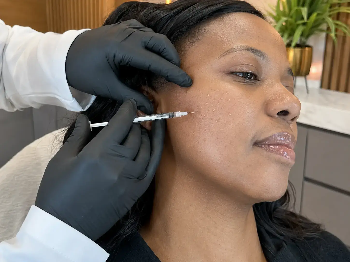 Skin Booster Treatment — hydration and skin quality, Durban North