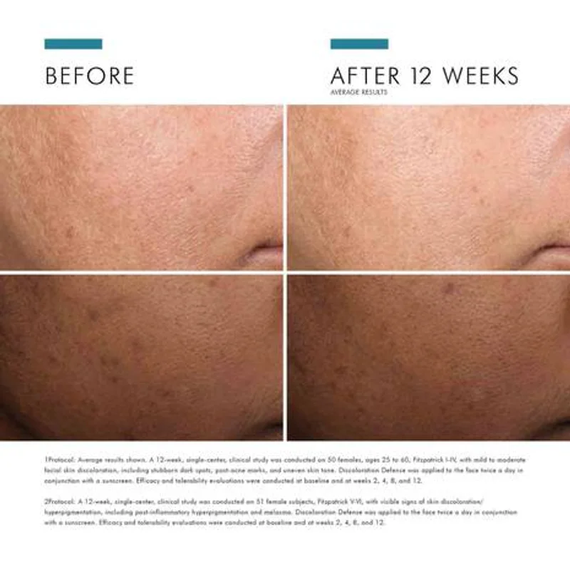 SkinCeuticals Discoloration Defense image 5